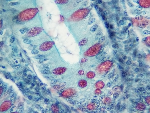 Simple Columnar Epithelium Slides - Simple Columnar Epithelium 18 400X